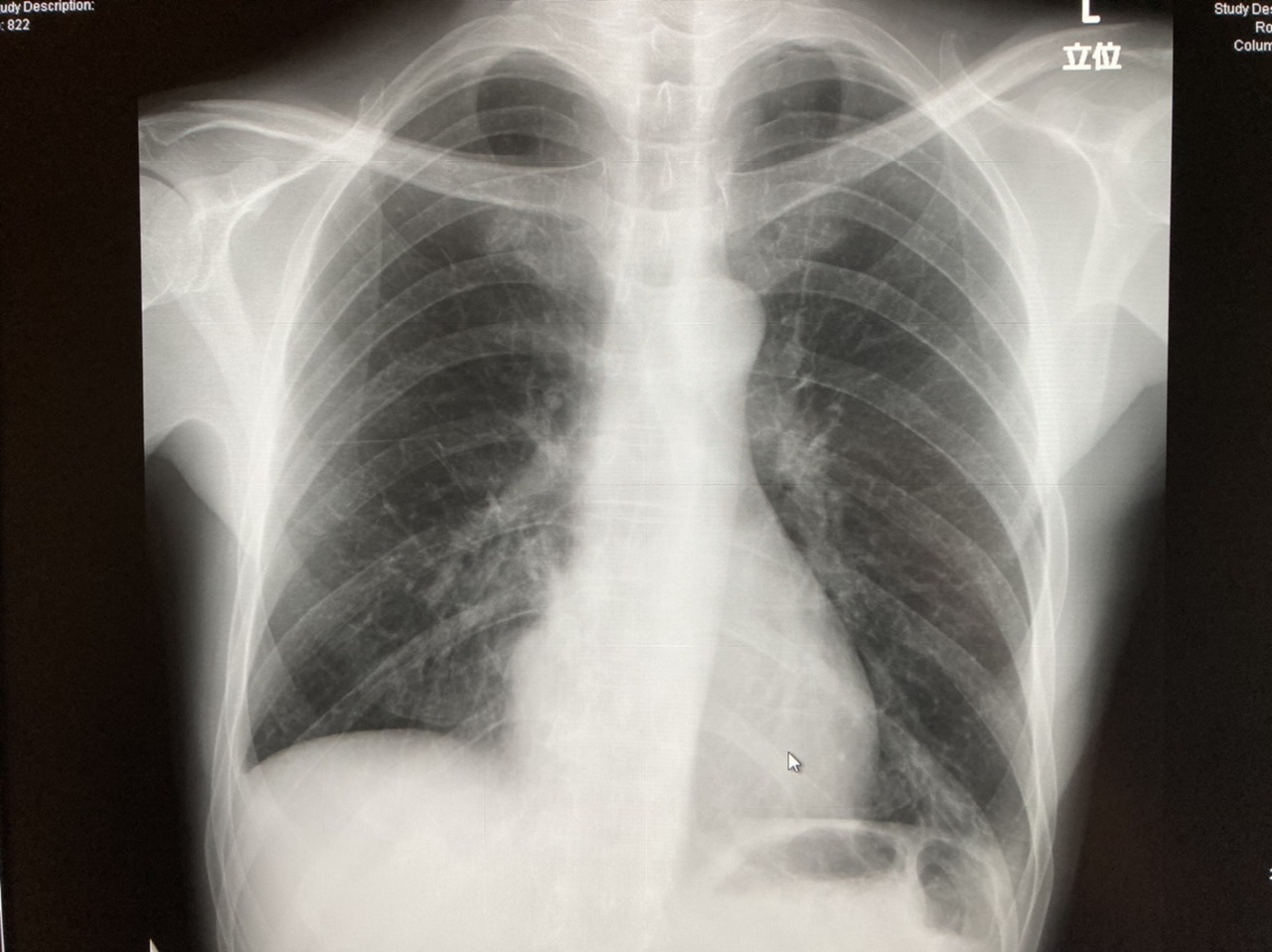 医師の診察を受ける時期